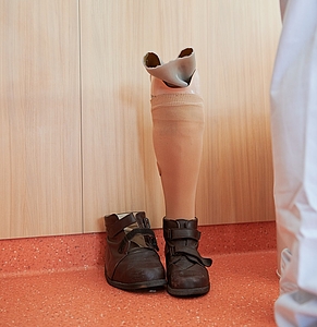 herkömmliche Schaftprothese